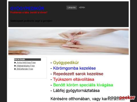 Gyogypedikur - lábápolás,gyógypedikűr,körömgomba,tyúkszem ...