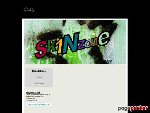 Sk1nzone